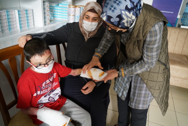 Korona aşı çalışmaları kelebek hastalarına umut oldu